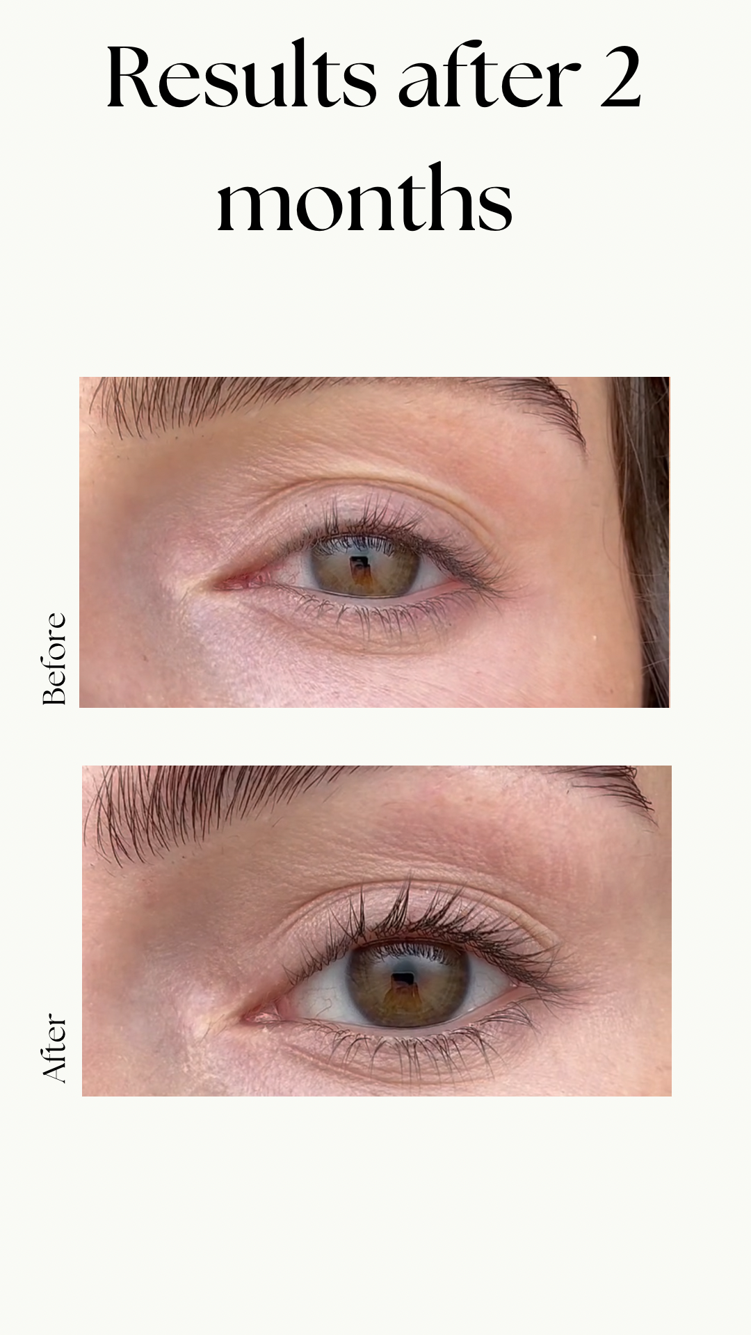 Peptide Lash Growth Serum 1+1 GRATIS
