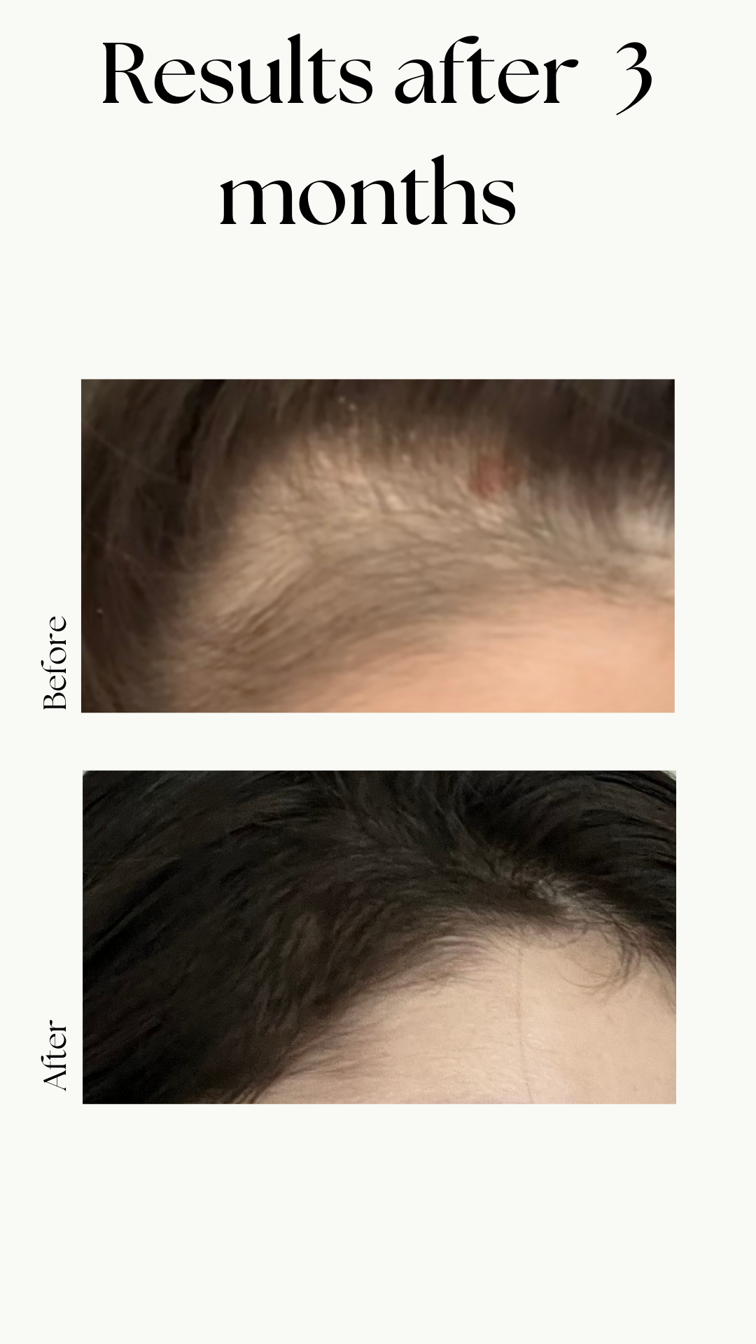 Hair Growth Oil