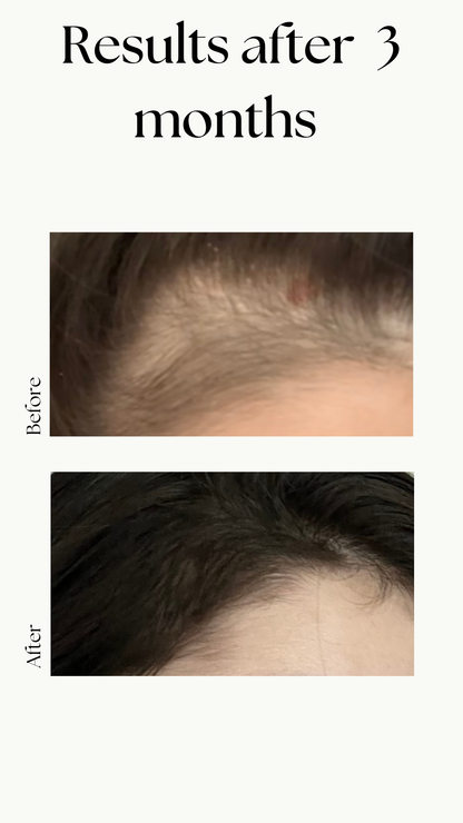Hair Growth Oil